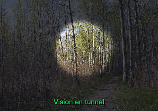 Image d'une vision en tunnel